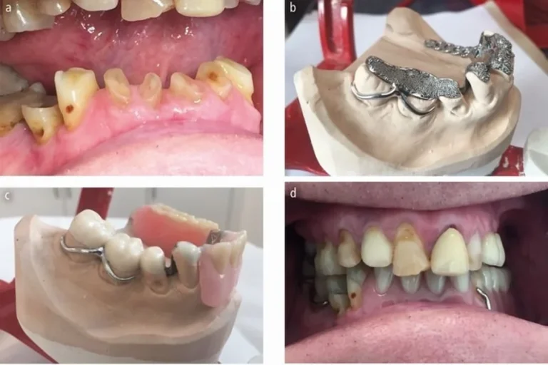 General Dentistry