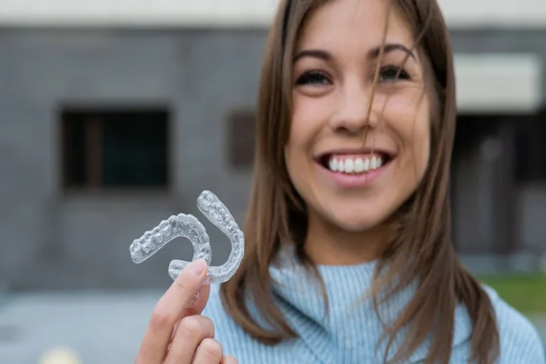 Clear Aligners